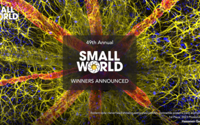 Nikon Small World Competition: Illinois Researchers Featured